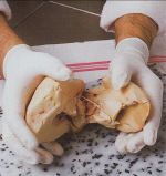 Foie gras